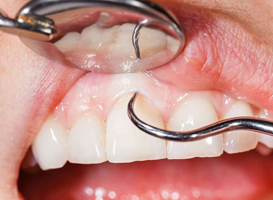 periodontia dentista em hortolândia